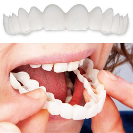 Perfect Smile Veneers