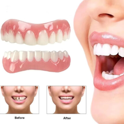 Instant Smile Lower Teeth